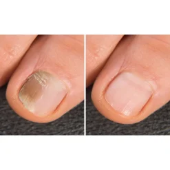 Nagel- & Fußpflegeprodukte·Nagellack|Die moderne Hausfrau Anti-Fuss- und Nagelpilzspray, 100 ml