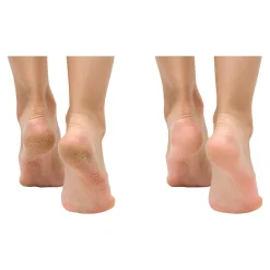 Nagel- & Fußpflegeprodukte·Nagellack|Die moderne Hausfrau Anti-Fuss- und Nagelpilzspray, 100 ml