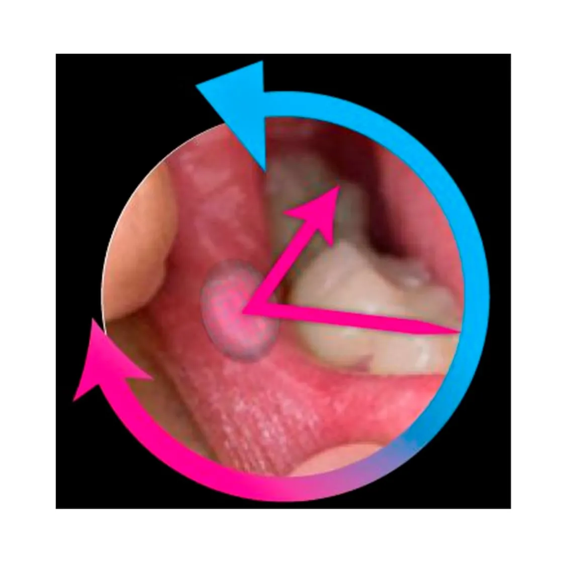 Zahnpflegeprodukte·Zahnpasta & Mundgel|Die moderne Hausfrau AphtoFix Plus, 10 g