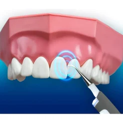 Zahnpflegeprodukte·Gebiss- & Zahnreiniger|Die moderne Hausfrau DentaPic Sonic Schall-Zahnreiniger