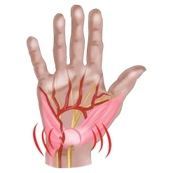 Bandagen·Handgelenkbandagen|Die moderne Hausfrau Handgelenkbandage rechts