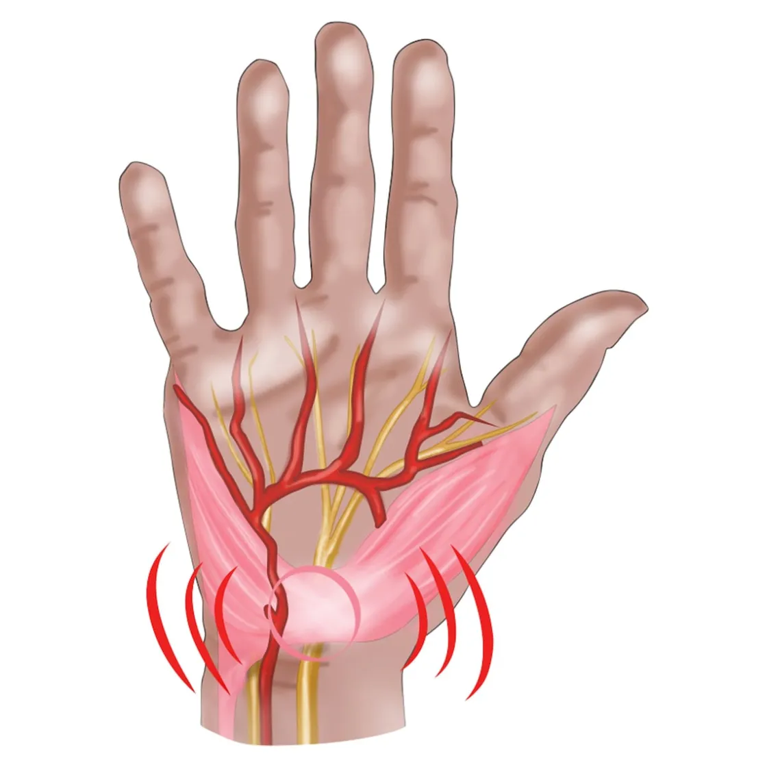 Bandagen·Handgelenkbandagen|Die moderne Hausfrau Handgelenkbandage rechts