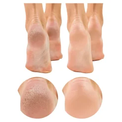 Fußpflegeprodukte·Hornhautentferner|Nagel- & Fußpflegeprodukte·Hornhautentferner|Die moderne Hausfrau Horn-und Nagelhaut-Entferner, 200 ml