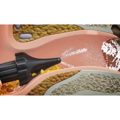 Die moderne Hausfrau Ohrenreiniger WUSH