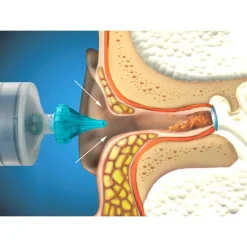 Ohrreiniger|Die moderne Hausfrau Ohrenwachs-Entfernungsspritze