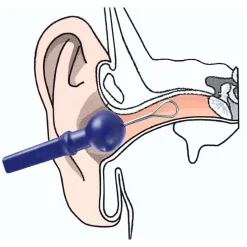 Ohrreiniger|Die moderne Hausfrau Sicherheits-Ohrreiniger einzeln