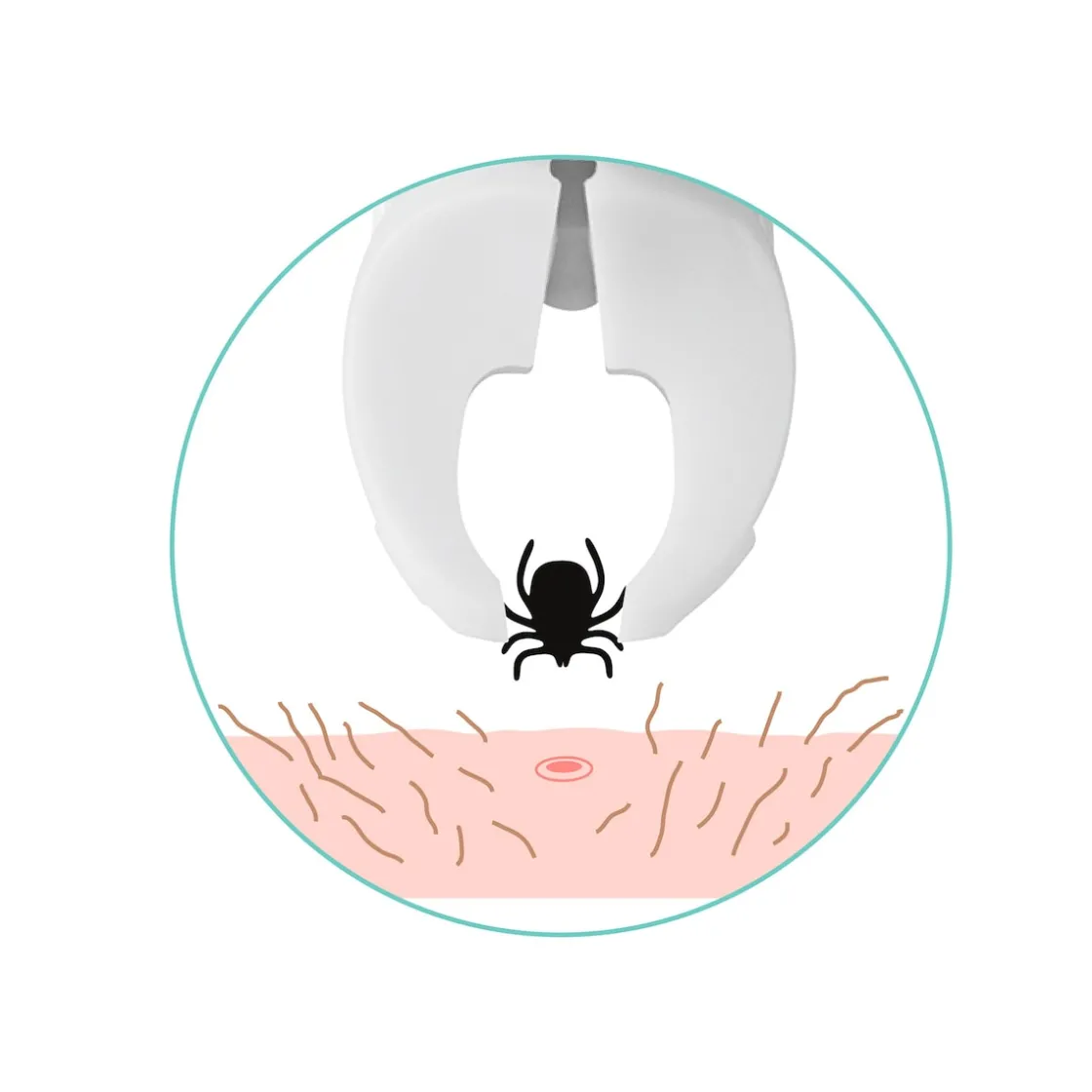 Kosmetikprodukte·Pinzetten|Die moderne Hausfrau Zeckengreifer tickSAFE, Tier, mit rotierendem Greiferkopf